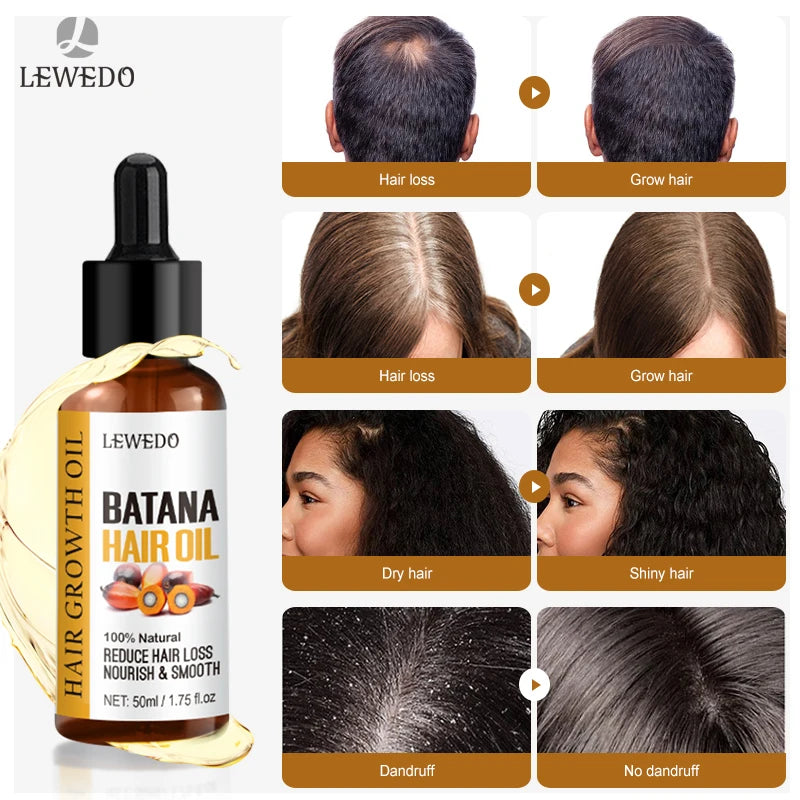 Hair Growth Batana Oil | Fast Growing Repair Serum | Anti-Hair Loss